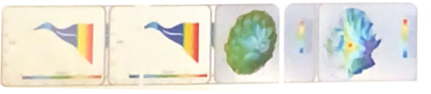 Air Suspension Blower